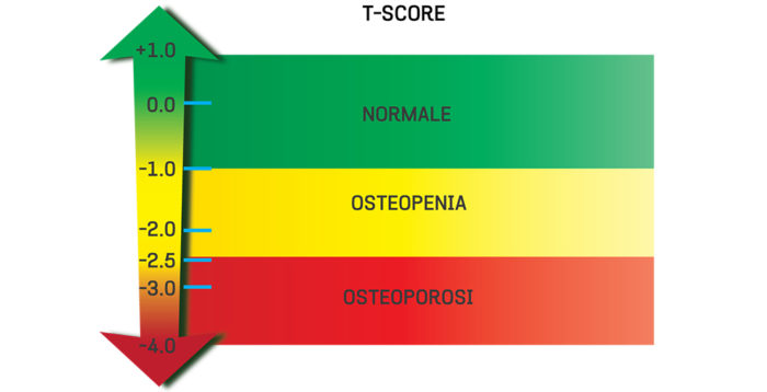 osteoporosis-firomms